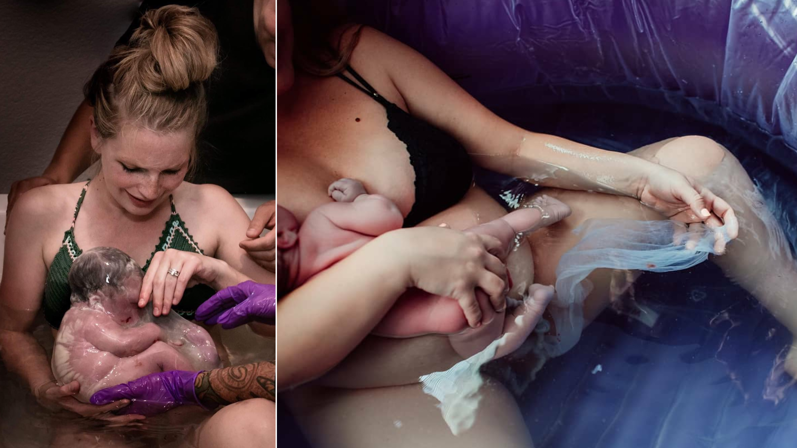 25 Rare Photos of Babies Born in the Amniotic Sac