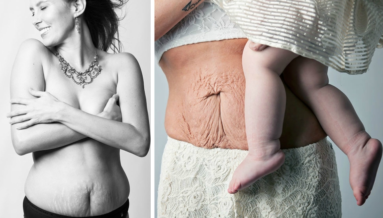 What Women's Bodies Really Look Like After Childbirth