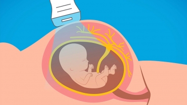 Advanced Prenatal Genetic Testing