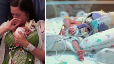 A Mother’s Love: Premature Baby Was Born 3 Months Early