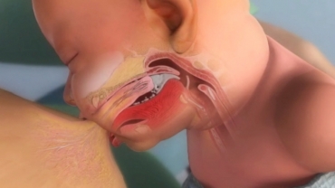 How a Baby's Mouth is Specially Formed to Help Breast Feeding?