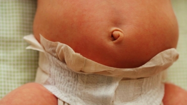 How to Care for Newborn's Belly Button
