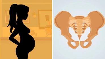 Ways to Ease Pelvic Pain During Pregnancy