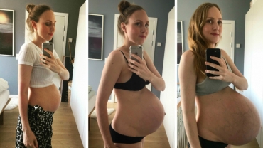 What 3 Kids Growing in One Belly Does to Your Body?