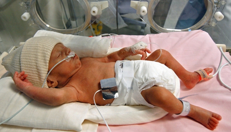 Newborn Care: Concerns for Premature Babies