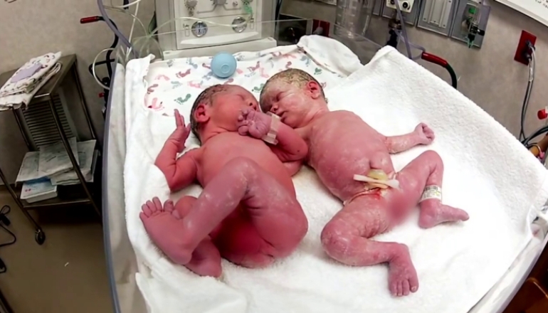 Newborn Twins First Meeting