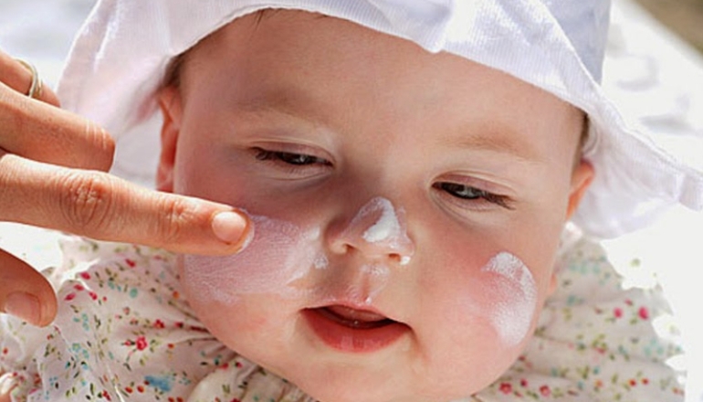 What You Need to Know About Baby Sunburn Treatment