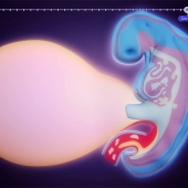 Early Development of a Human Embryo