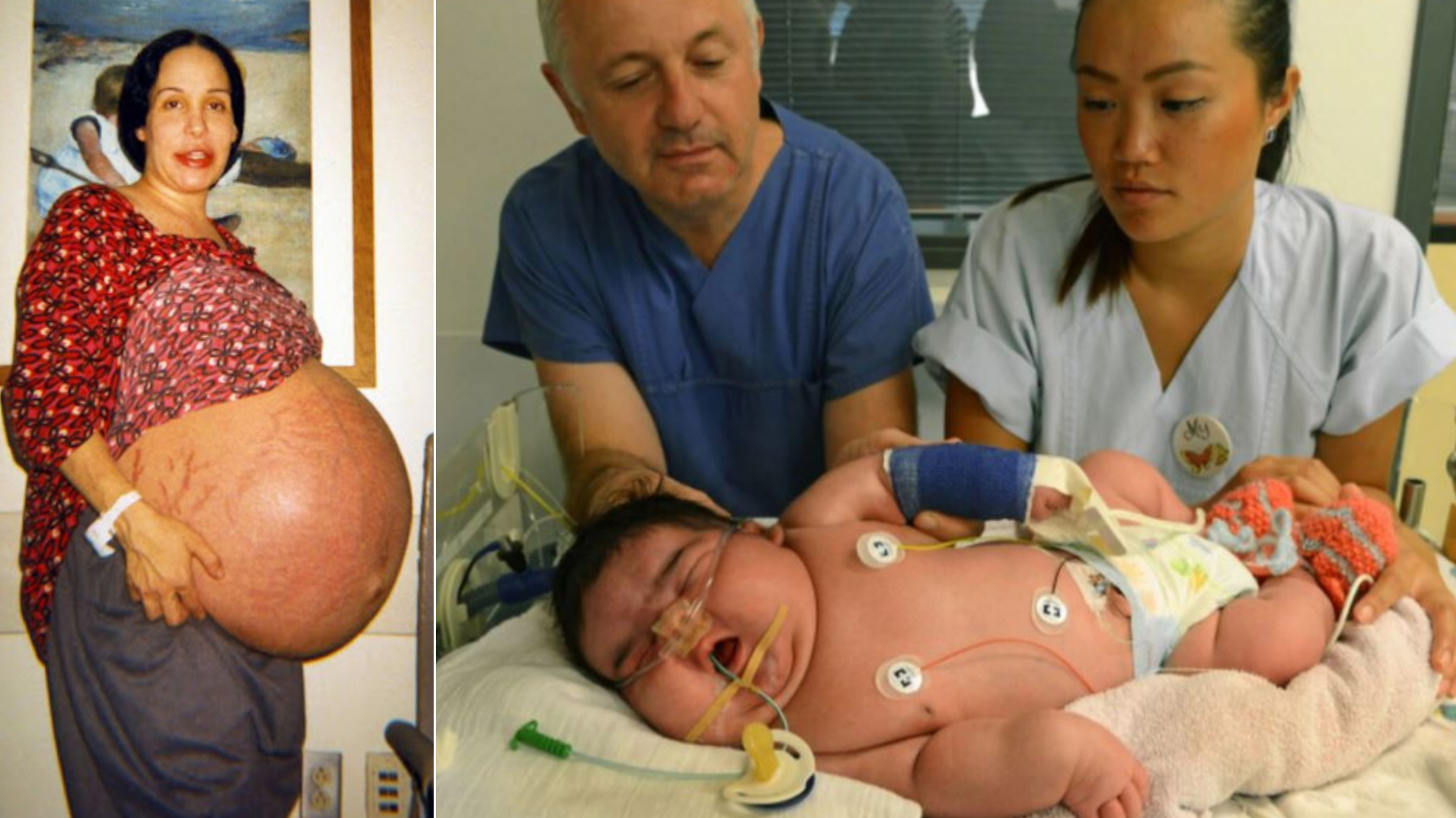 Incredible Record-breaking Childbirths and Babies