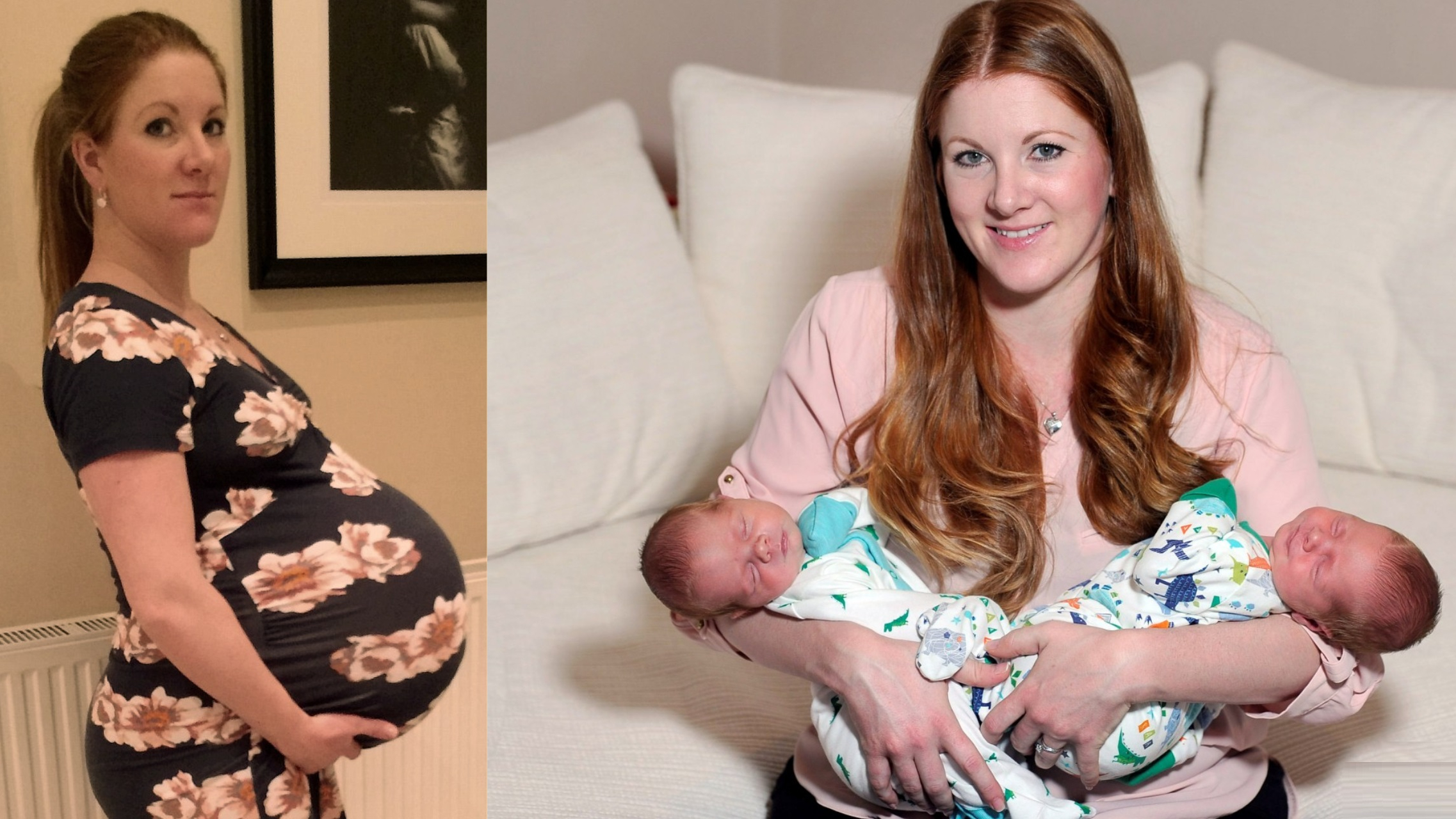 Mom Gives Birth To The Heaviest Twins In Scotland