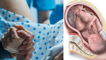 3 Major Ways to Prevent Vaginal Tearing During Birth