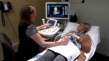 4D Baby Ultrasound