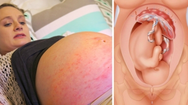 9 Pregnancy Facts Every Woman Should Know