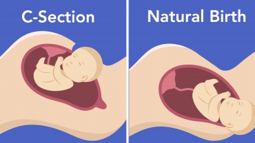 Doctors Answer Commonly Googled Pregnancy Myths