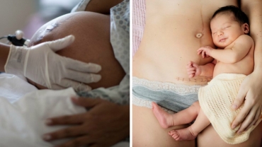 Everything You Need to Know About Having a C-Section: Pros and Cons