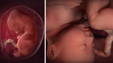 Alcohol Consumption During Pregnancy