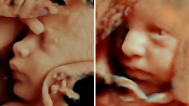 Amazing Things Fetuses Do in the Womb