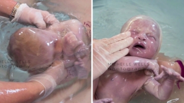 Baby Born in Amniotic Sac: Mateja’s Birth