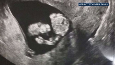 Baby 'Salutes' Former Marine Dad in Adorable Sonogram Photo