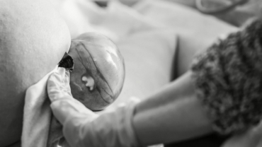 Baby Was Born in the Caul After a Powerful Labor