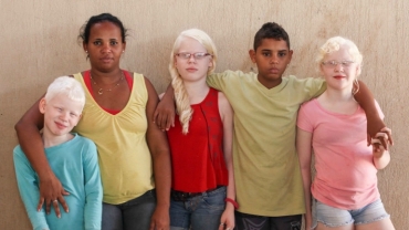 Black Brazilian Family Have Three White-Skinned Children