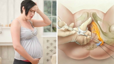 Different Pain Relief Options During Labour and Birth