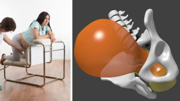 Dynamic Positions in Birth: Upright Position Can Make Delivery Easier