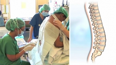 Epidural Anesthesia for Childbirth