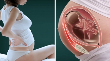 Every Pregnant Woman Should Know About Round Ligament Pain