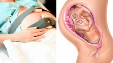 First Stage of Labour: What You Can Expect to Happen?