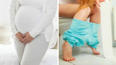Frequent Urination During Pregnancy