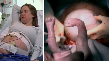 Giving Birth to Twins