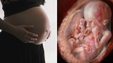 How Rh Factor Affects a Pregnancy