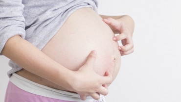 How to Deal with an Itchy Pregnancy Stomach?