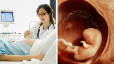 Life in the Womb: First Scan