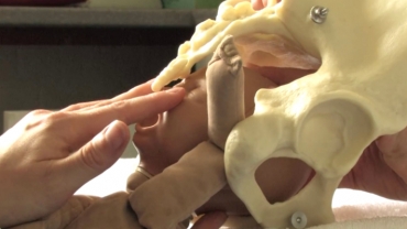 Mechanism of Vaginal Breech Delivery