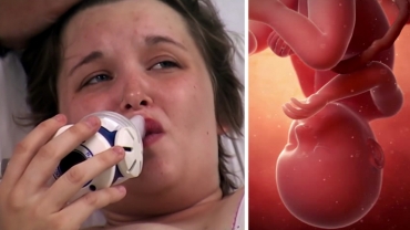 Meconium During Labour: Baby Pooping in Womb