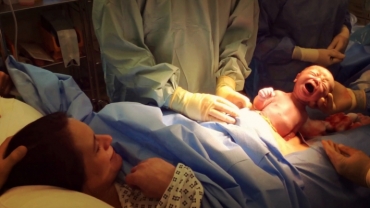Natural Caesarean: A Baby Delivering Itself During a C-Section