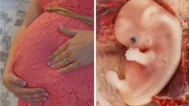 Normal Fetal Movement and Growth