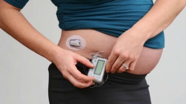 Pregnancy and Type 1 Diabetes