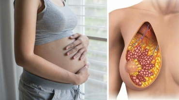 Pregnancy: Where Your Breast Milk Starts