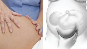 Prenatal Abdominal Examination: Leopold's Maneuvers