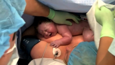 Skin-to-Skin Contact After Cesarean Birth