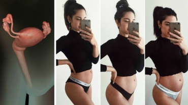 Smaller Baby Bump Due to Backwards Uterus?