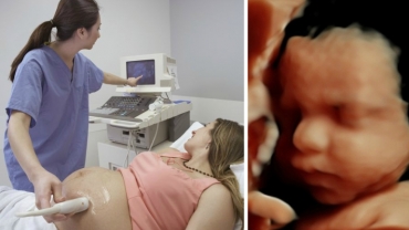 Ultrasound Scans: What You Will Be Able to Find Out About the Baby?