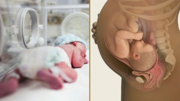 Understanding Infant Brain Injuries at Birth