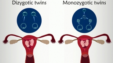 What is Multiple Pregnancy?