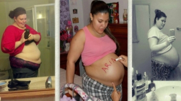 Plus Size Pregnancy: What’s a B Belly?