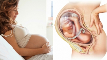 Why Are Babies Breech?