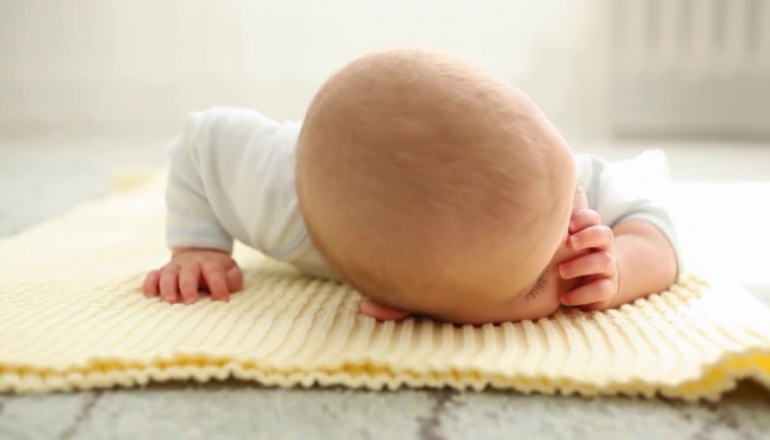 Cradle Cap (Seborrheic Dermatitis in Babies)